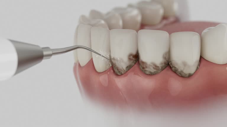 Reliable Dental Implants contractor in Bay Hill, FL by Smile Center Dentistry